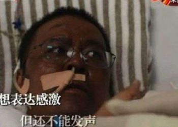 Dr Hu Weifeng, dokter di Wuhan yang menjadi viral pada April setelah kulitnya menghitam dikarenakan pengobatan virus corona. Dia meninggal pada Selasa (2/6/2020) setelah lima bulan berjuang. Foto: CCTV